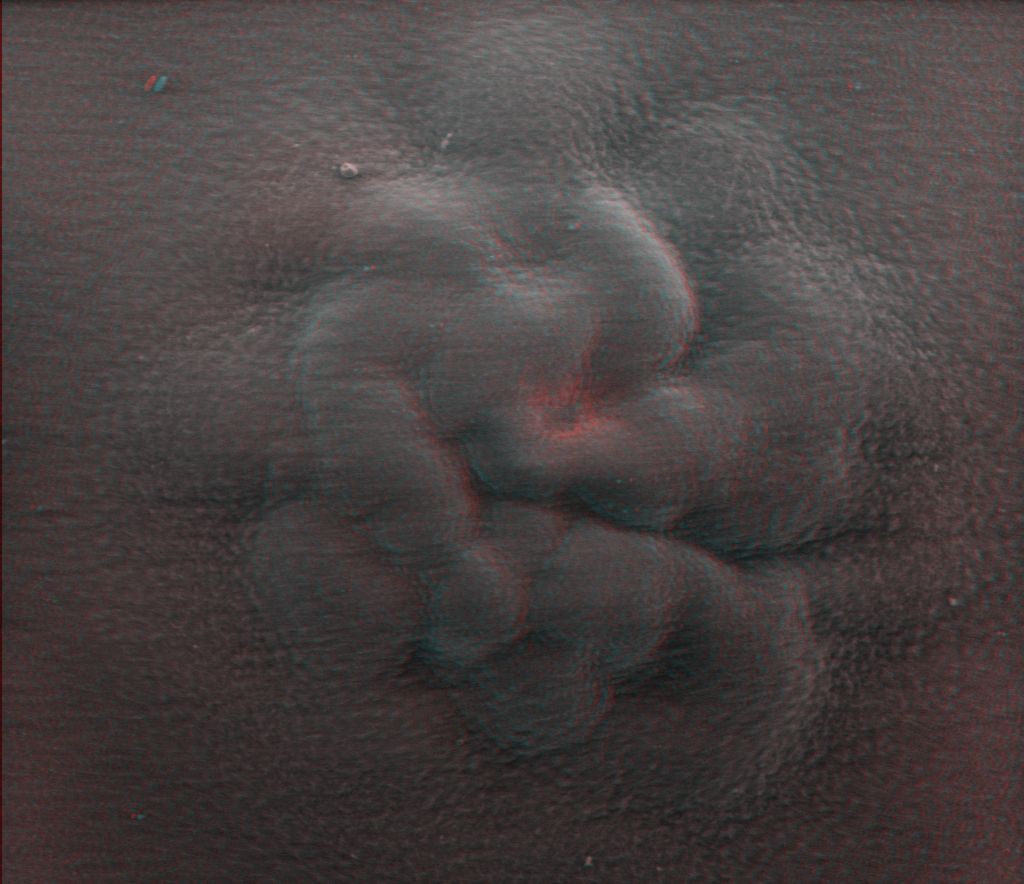 Red-blue anaglyph of HepG2 cell spheroid under a gelatine matrix.